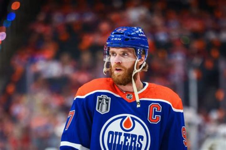Connor McDavid Tattoo And Face: Edmonton Oilers Captain Hair
