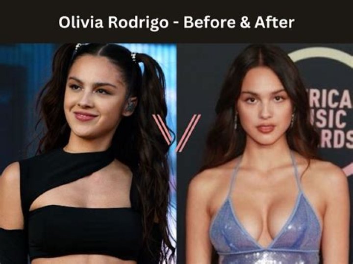 Did Olivia Rodrigo Get Breast Implants? Before And After Plastic Surgery Photos Compared