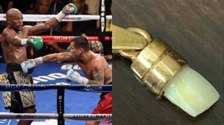 Floyd Mayweather claims Maidana never removed his tooth during a fight