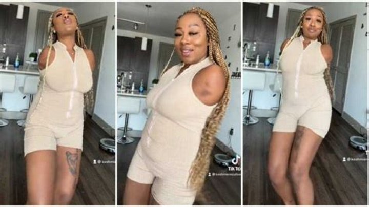 "My Happiness is From Within": Beautifully Lady Who Has No Hands Dances Joyfully With Swag, Video Goes Viral