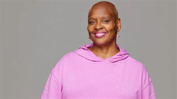 Why Is Felicia Bald On Big Brother? Alopecia Update 2023